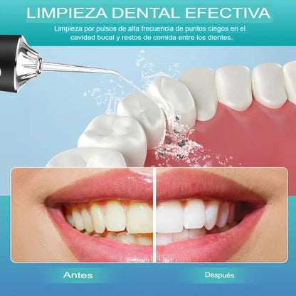 Irrigador Bucal Portátil Premium